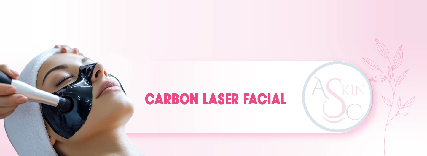 Carbon Laser Facial in Bhopal