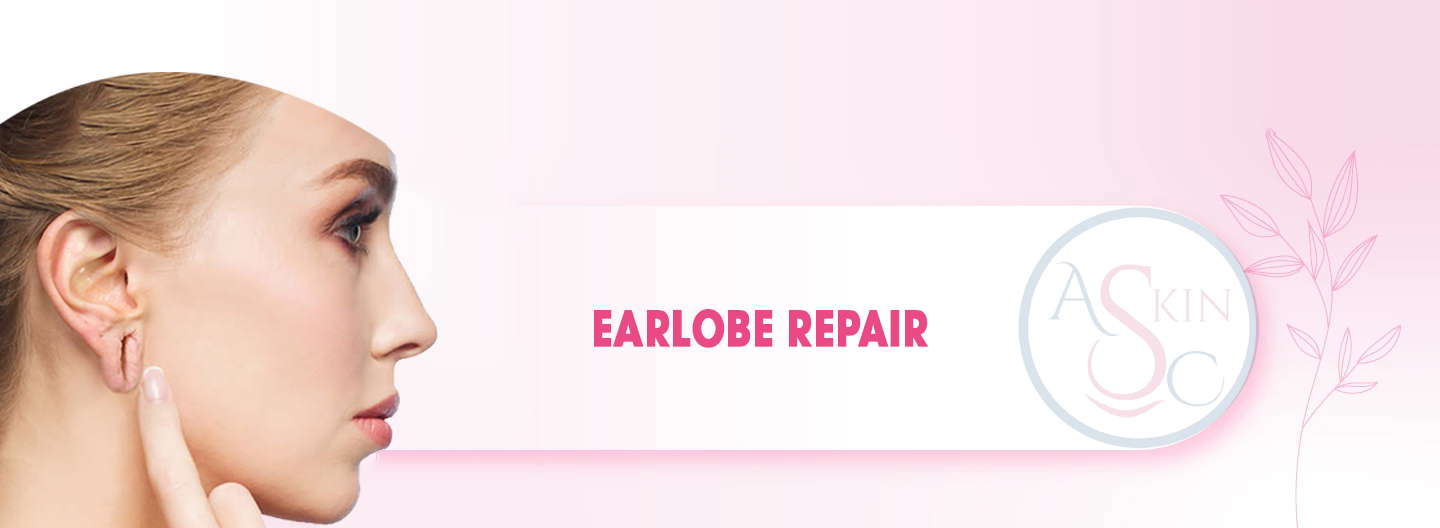 Earlobe Repair in Bhopal