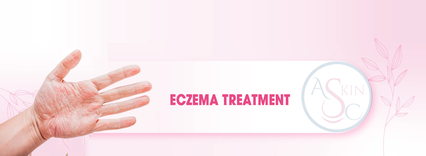 Eczema Treatment in Bhopal