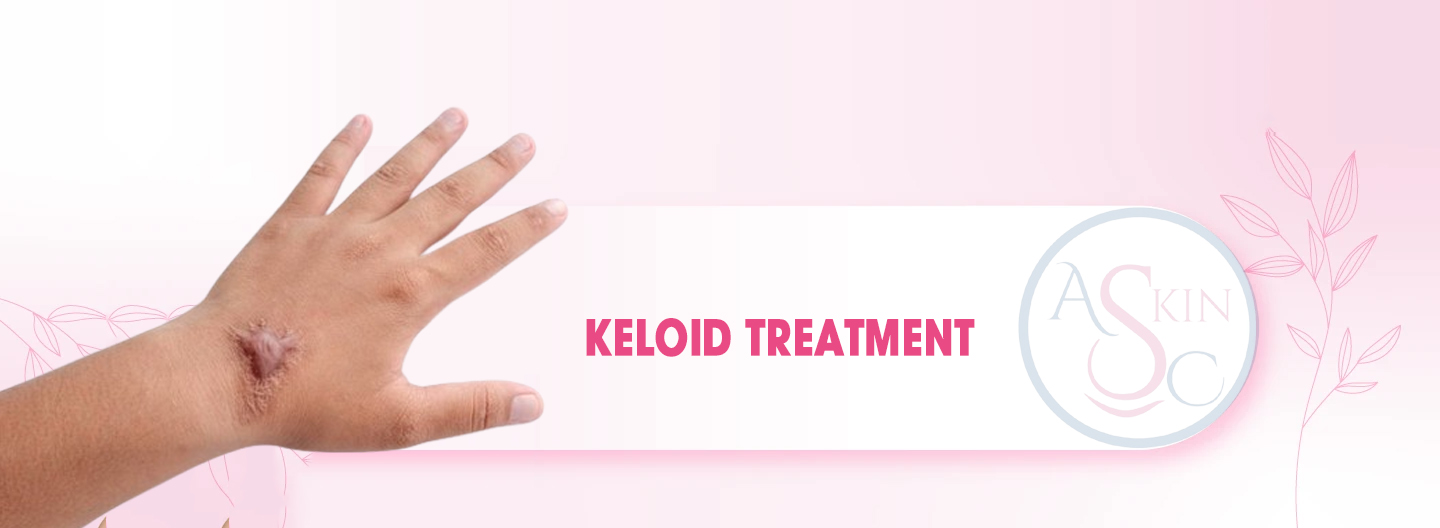 Keloid Treatment in Bhopal