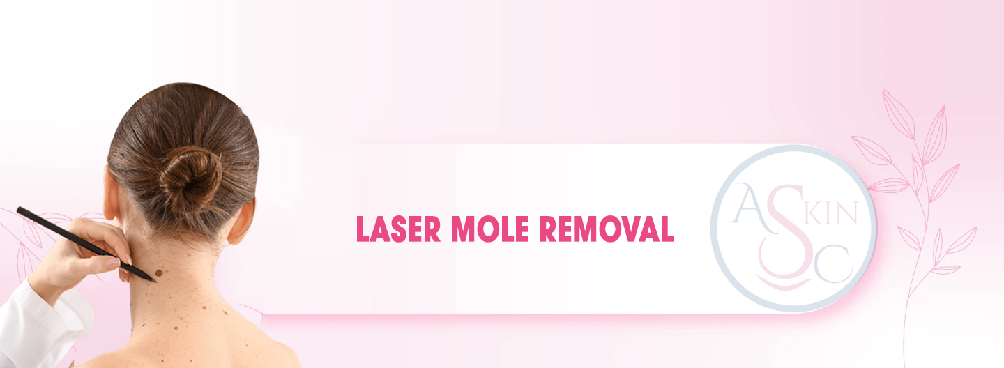 Laser Mole Removal Bhopal