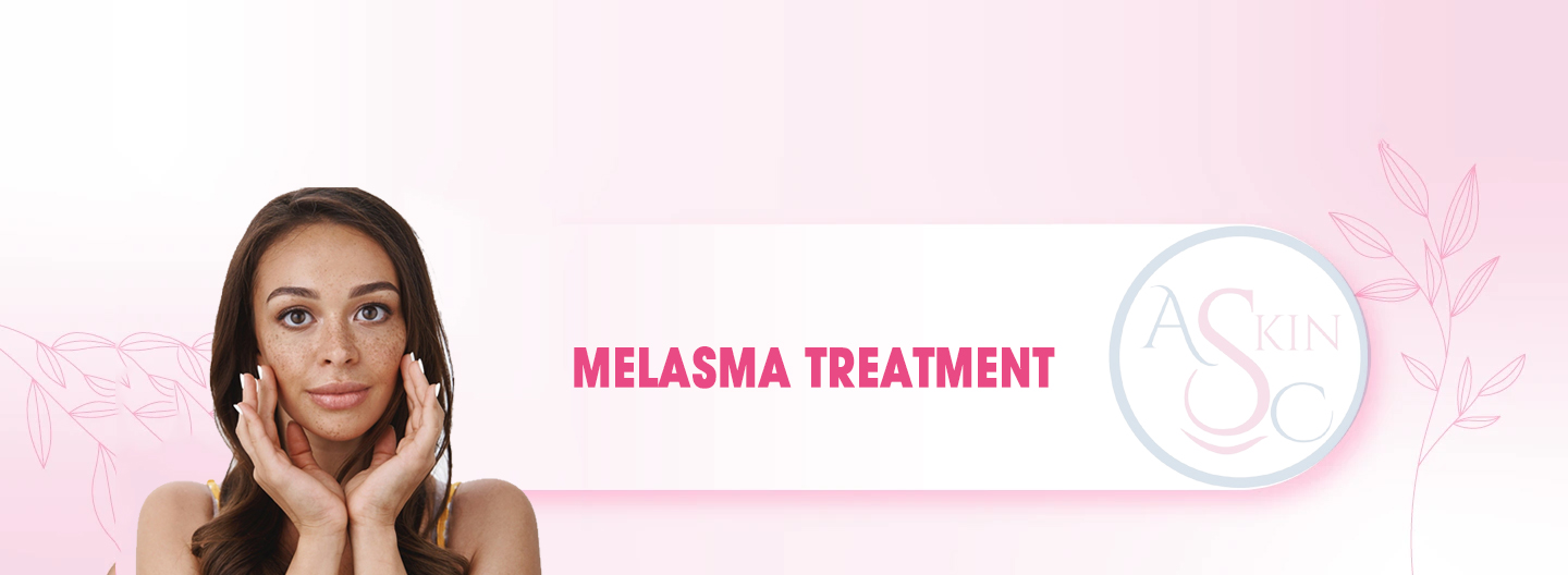 Melasma Treatment in Bhopal