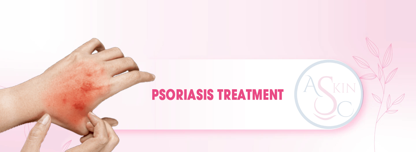 Psoriasis Treatment in Bhopal