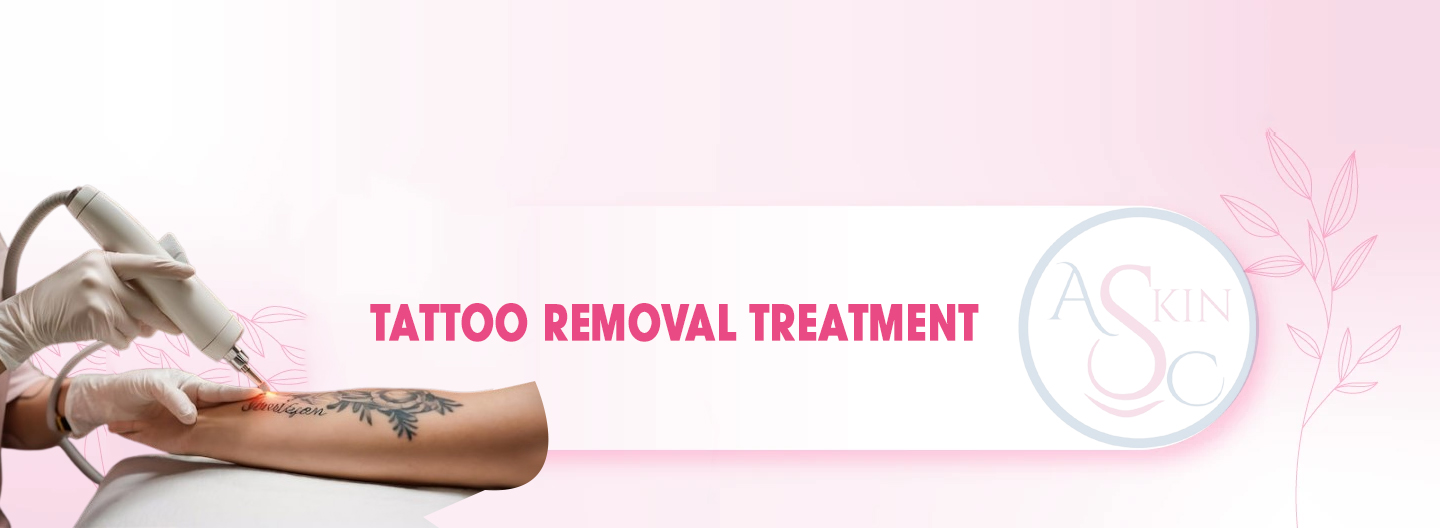 Laser Tattoo Removal Bhopal