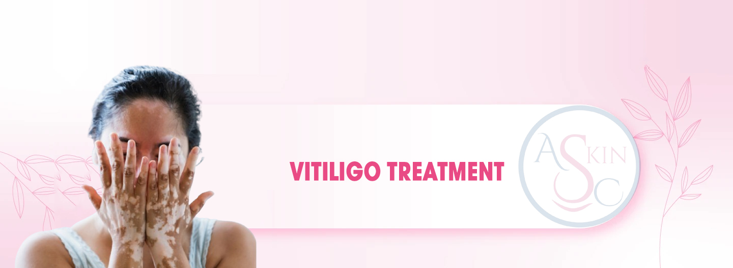 Vitiligo Treatment in Bhopal