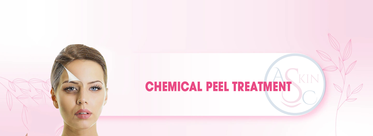 Chemical Peel Treatment in Bhopal