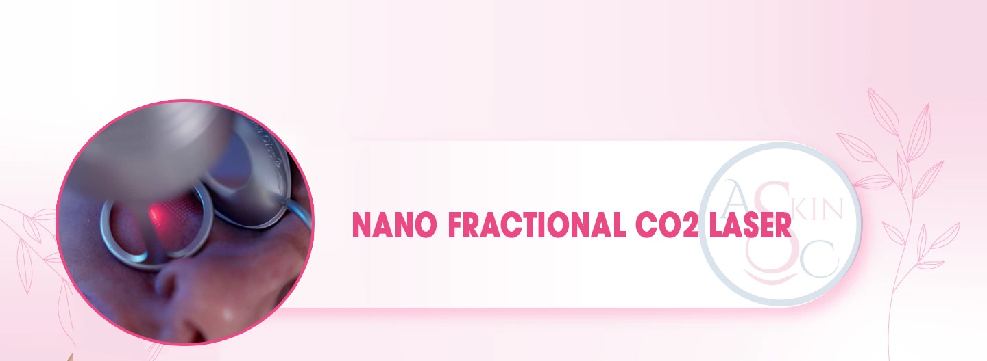 Best Laser Acne Scar Treatment in bhopal